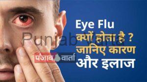 Read more about the article आँखों का फ्लू: कारण और घरेलू उपाय