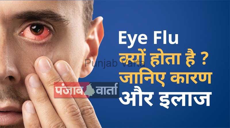 Read more about the article आँखों का फ्लू: कारण और घरेलू उपाय